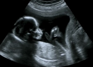 Clínicas y Hospitales con Ultrasonido en Santiago